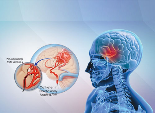 portfolio-man-cheers