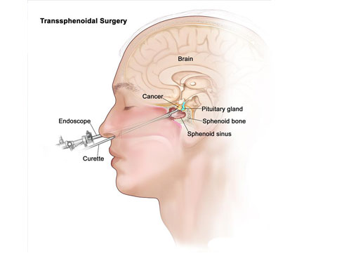 portfolio-man-style-capoo